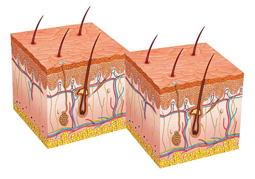 трихология - срез кожи головы трихология - срез кожи головы